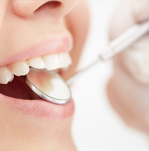 歯周病を放置すると？